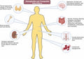 Comparative safety and side effects of semaglutide and tirzepatide: Implications for clinical decision-making in obesity management