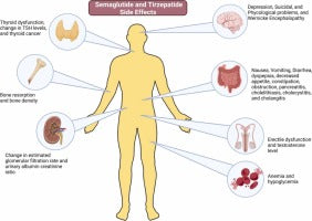 Comparative safety and side effects of semaglutide and tirzepatide: Implications for clinical decision-making in obesity management