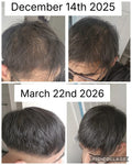 GHK-Cu Peptides Before and After: Dosage, Benefits & How It Works for Skin and Hair